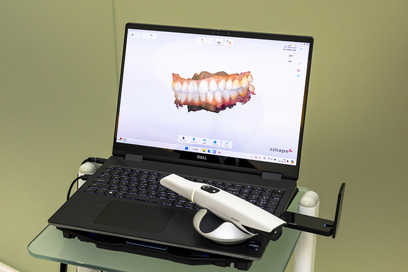 口腔内スキャナーを使用したインプラント治療安全かつ精密なシミュレーション